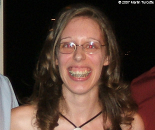 Marie-Hélène Cyr - Before orthognathic surgeries (September 8, 2007)